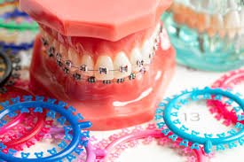 😁 Orthodontics | تقويم الأسنان من الأساس لحد الفهم العملي