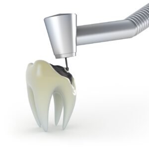 🦷 Dental Operative | أساسيات علاج وحشو الأسنان بطريقة سهلة